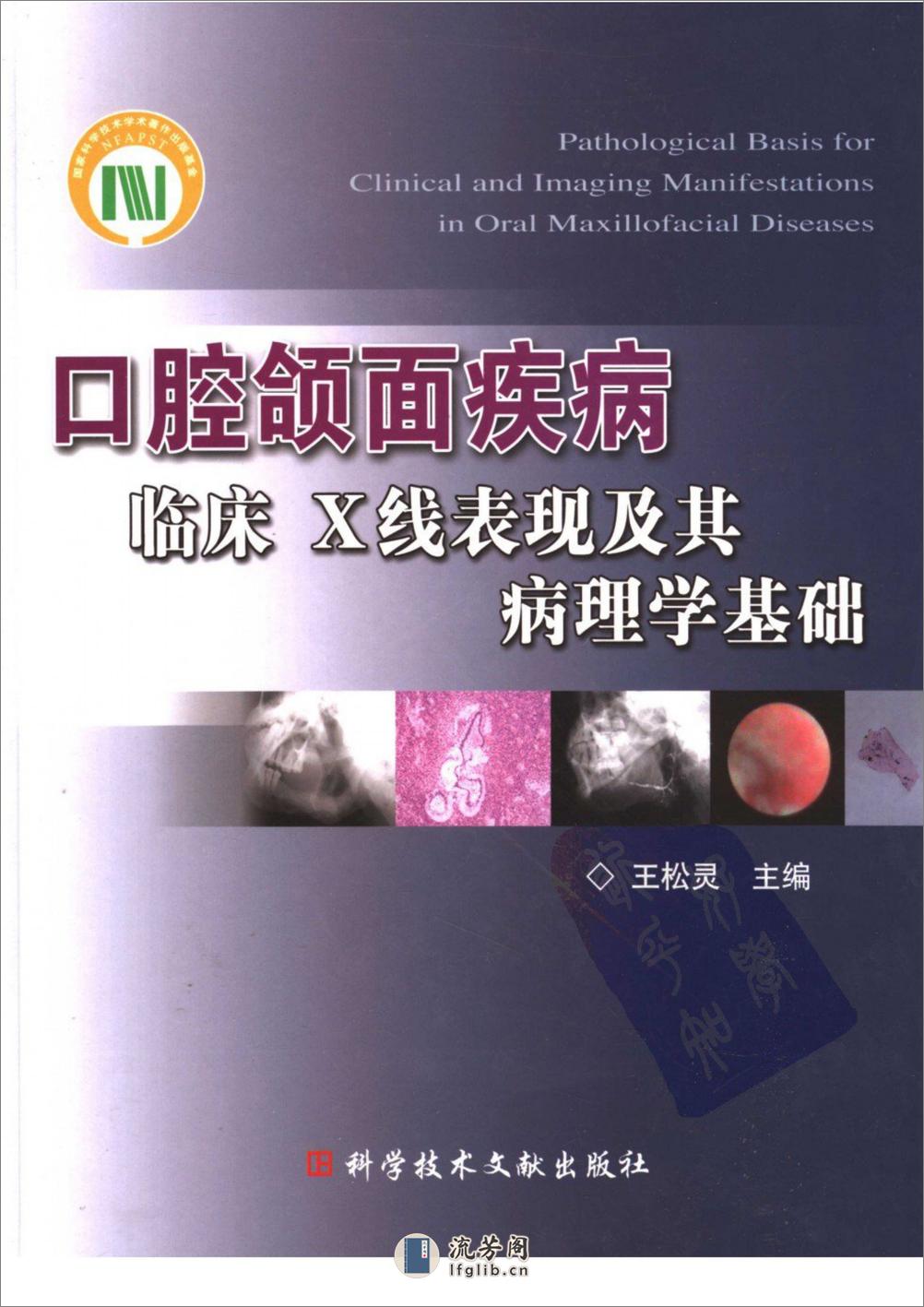 口腔颌面疾病临床X线表现及其病理学基础_1... - 第1页预览图