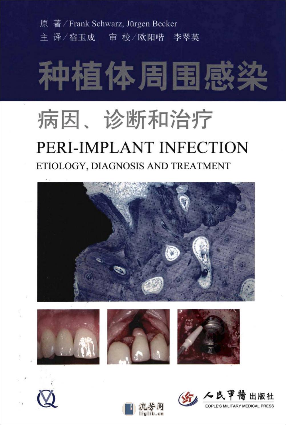 种植体周围感染病因、诊断和治疗_12808038_... - 第1页预览图